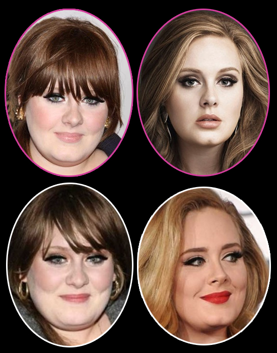 Adele Nose Job