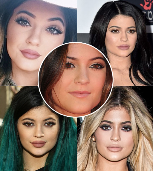 Kylie Jenner Plastic Surgery