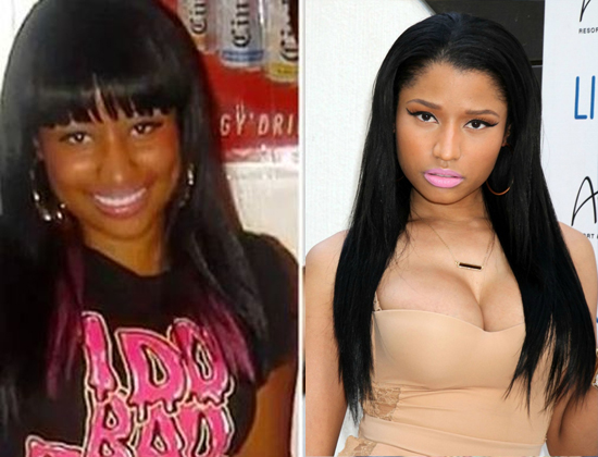 Nicki Minaj plastic surgery