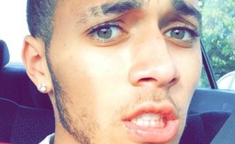 kalin white